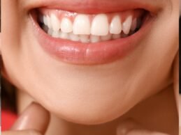 Botox Sonrisa Gingival