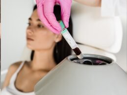 PRP (Plasma Rico en Plaquetas)